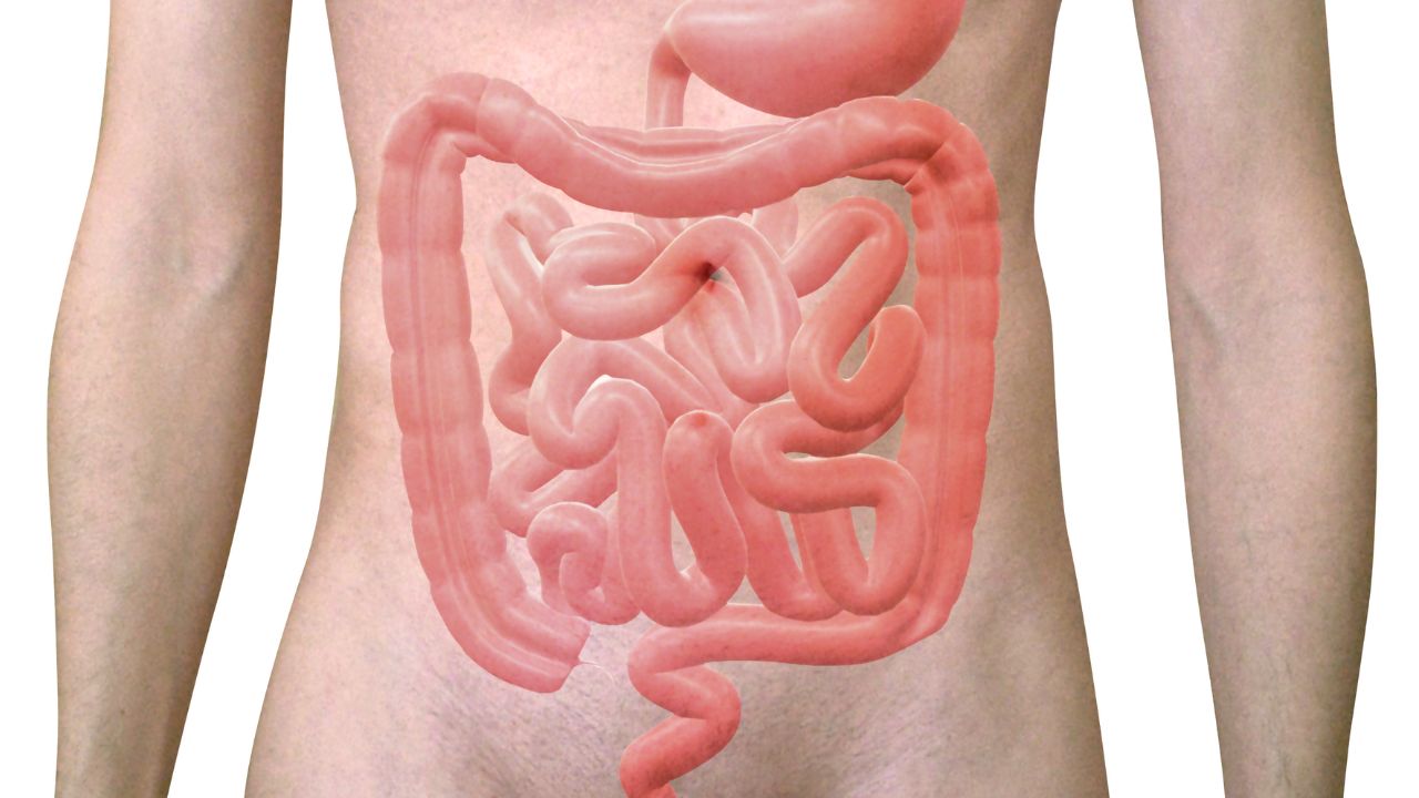 cancro colon retto screening