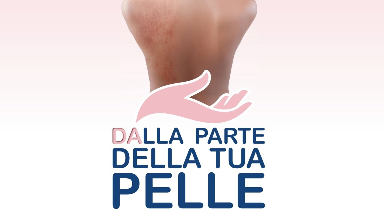 dermatite atopica open day